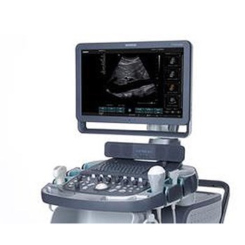 西门子 Siemens 超声诊断系统 ACUSON X600 